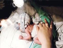 Doğumların yüzde 10'u prematüre
