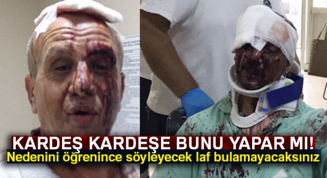 Ağabey-kardeş arasındaki miras kavgası kanlı bitti: 5 yaralı