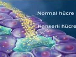 Uzun süreli iltihap kanser nedeni